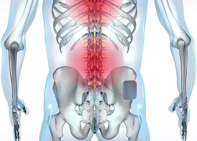 Lower Back Muscle Strain Doctor